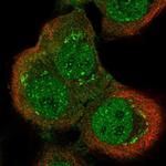 ARHGAP32 Polyclonal Antibody