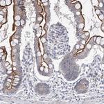 ARHGAP32 Antibody in Immunohistochemistry (IHC)
