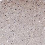 ARHGAP32 Antibody in Immunohistochemistry (IHC)