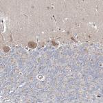 ARHGAP32 Antibody in Immunohistochemistry (IHC)