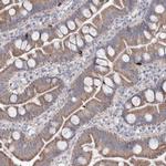 MTCH2 Polyclonal Antibody