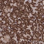 TGFBRAP1 Polyclonal Antibody