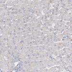 ARSI Antibody in Immunohistochemistry (Paraffin) (IHC (P))