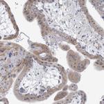 ARSI Antibody in Immunohistochemistry (Paraffin) (IHC (P))