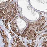 ARSI Polyclonal Antibody