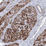 ARSI Antibody in Immunohistochemistry (Paraffin) (IHC (P))