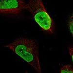 C10orf97 Polyclonal Antibody