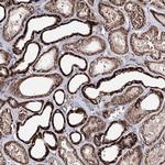 C10orf97 Antibody in Immunohistochemistry (Paraffin) (IHC (P))