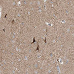 C10orf97 Antibody in Immunohistochemistry (Paraffin) (IHC (P))