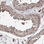 C10orf97 Antibody in Immunohistochemistry (Paraffin) (IHC (P))