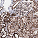 C10orf97 Antibody in Immunohistochemistry (Paraffin) (IHC (P))