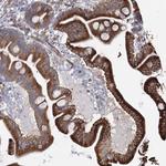 ZCCHC9 Polyclonal Antibody