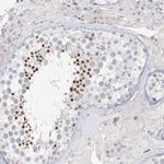 C6orf222 Polyclonal Antibody