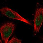 C11orf1 Polyclonal Antibody