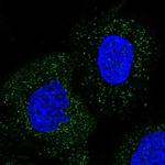 WDR48 Polyclonal Antibody