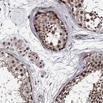 PRPF40B Antibody in Immunohistochemistry (IHC)