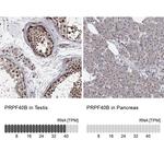PRPF40B Antibody