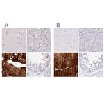 MYOZ1 Antibody in Immunohistochemistry (IHC)
