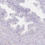 MYOZ1 Antibody in Immunohistochemistry (IHC)