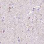 MYOZ1 Antibody in Immunohistochemistry (IHC)