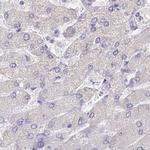 MYOZ1 Antibody in Immunohistochemistry (IHC)