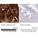 MYOZ1 Antibody