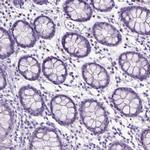 SPAG6 Antibody in Immunohistochemistry (IHC)