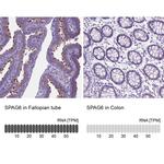 SPAG6 Antibody