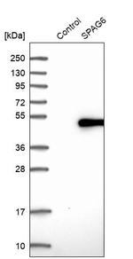 SPAG6 Antibody in Western Blot (WB)