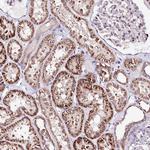 ATE1 Antibody in Immunohistochemistry (Paraffin) (IHC (P))
