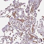 ATE1 Antibody in Immunohistochemistry (Paraffin) (IHC (P))