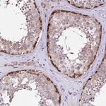 ATE1 Antibody in Immunohistochemistry (Paraffin) (IHC (P))