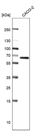 ATE1 Antibody in Western Blot (WB)