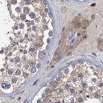 RTKN2 Antibody in Immunohistochemistry (IHC)