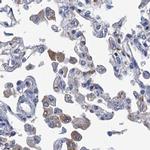 RTKN2 Antibody in Immunohistochemistry (IHC)