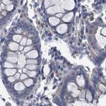 RTKN2 Antibody in Immunohistochemistry (IHC)