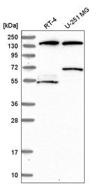 RTKN2 Antibody in Western Blot (WB)