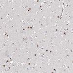 FRMD4A Antibody in Immunohistochemistry (Paraffin) (IHC (P))