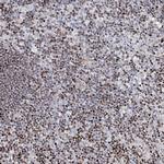 FRMD4A Antibody in Immunohistochemistry (Paraffin) (IHC (P))