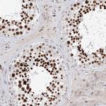FRMD4A Antibody in Immunohistochemistry (Paraffin) (IHC (P))