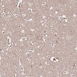 REXO2 Antibody in Immunohistochemistry (Paraffin) (IHC (P))