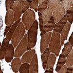 REXO2 Antibody in Immunohistochemistry (Paraffin) (IHC (P))