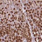 REXO2 Antibody in Immunohistochemistry (Paraffin) (IHC (P))