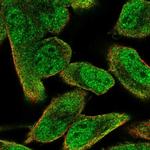 PIK3AP1 Polyclonal Antibody