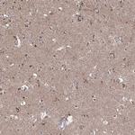 ARHGAP20 Polyclonal Antibody