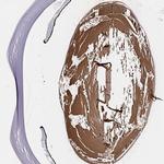 BFSP2 Polyclonal Antibody