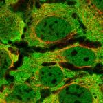 PPP6R3 Antibody in Immunocytochemistry (ICC/IF)