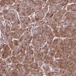 PPP6R3 Antibody in Immunohistochemistry (IHC)