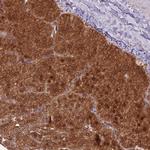 PPP6R3 Antibody in Immunohistochemistry (IHC)