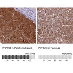 PPP6R3 Antibody